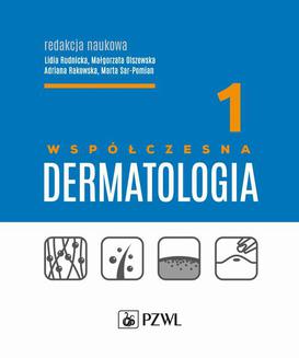 ebook Współczesna dermatologia tom 1