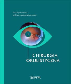 ebook Chirurgia okulistyczna
