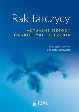 ebook Rak tarczycy. Aktualne metody diagnostyki i leczenia