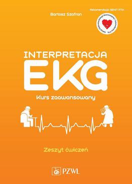 ebook Interpretacja EKG. Kurs zaawansowany. Zeszyt ćwiczeń