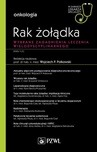 ebook W gabinecie lekarza specjalisty. Onkologia. Rak żołądka - Wojciech P. Polkowski