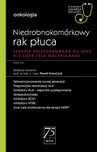 ebook W gabinecie lekarza specjalisty. Onkologia. Niedrobnokomórkowy rak płuca - Paweł Krawczyk