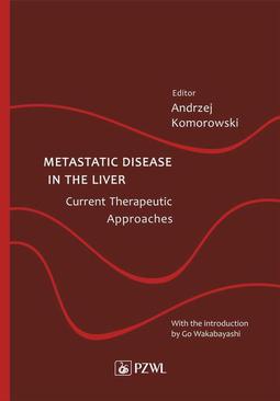 ebook Metastatic Disease in the Liver - Current Therapeutic Approaches