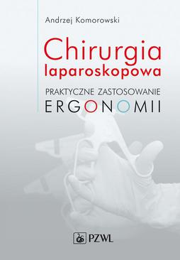 ebook Chirurgia laparoskopowa