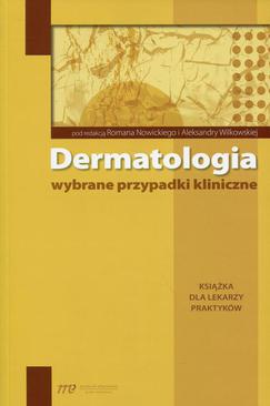 ebook Dermatologia - wybrane przypadki kliniczne