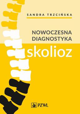 ebook Nowoczesna diagnostyka skolioz