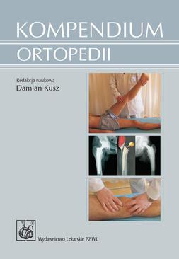 ebook Kompendium ortopedii