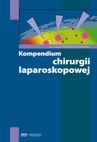 ebook Kompendium chirurgii laparoskopowej - 