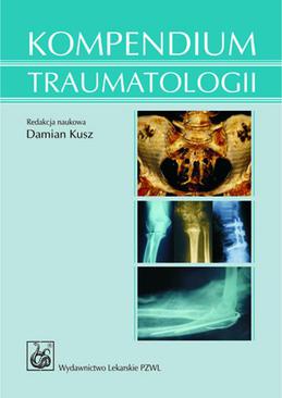 ebook Kompendium traumatologii