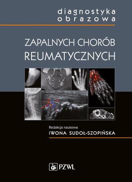 ebook Diagnostyka obrazowa zapalnych chorób reumatycznych