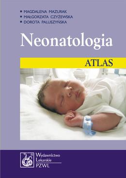 ebook Neonatologia