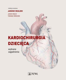 ebook Kardiochirurgia dziecięca