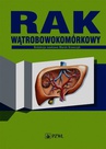 ebook Rak wątrobowokomórkowy - red. Marek Krawczyk