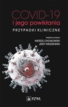 ebook COVID-19 i jego powikłania - przypadki kliniczne - Jerzy Kruszewski,Andrzej Chciałowski