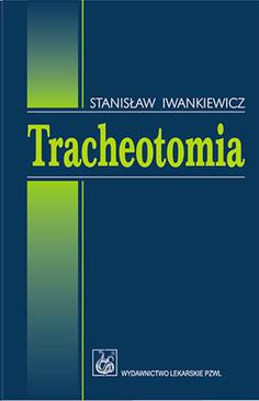 ebook Tracheotomia