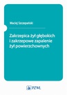 ebook Zakrzepica żył głębokich i zakrzepowe zapalenie żył powierzchownych - Maciej Szczepański