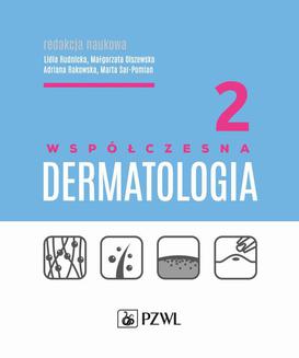 ebook Współczesna dermatologia tom 2