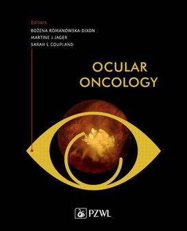 ebook Ocular Oncology